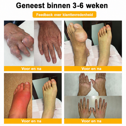 🔥 Laatste kans! Profiteer nu van deze geweldige aanbieding met 80% KORTING!  🎁 180 dagen niet-goed-geld-terug-garantie ✈️ Gratis verzending via luchtpost  Natravor®