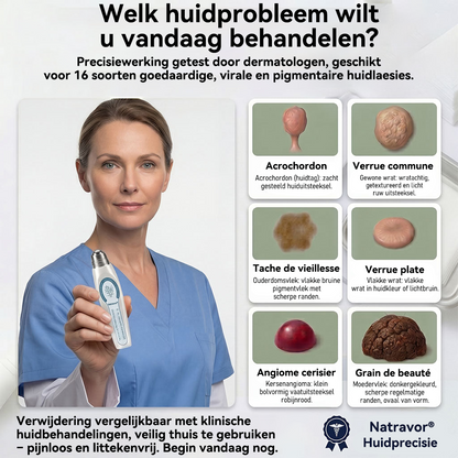 🔥 Alleen vandaag: 50% korting op je tweede item| 🖊️Natravor® 7-daagse wratten- en vlekkenverwijderaar (pijnstillende applicator voor nauwkeurig aanbrengen, laat geen littekens achter)🌳