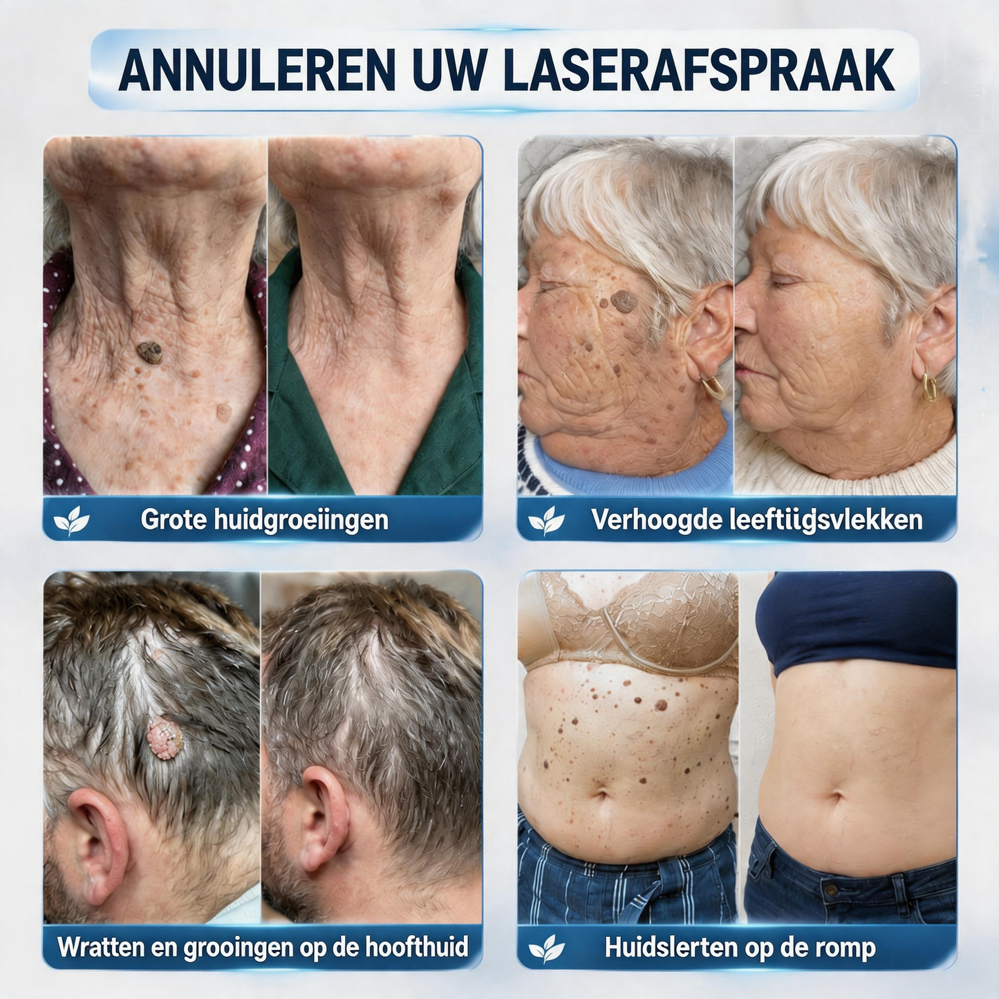 ❤️Natravor® Geavanceerde Corrigerende Crème voor Huidflapjes, Moedervlekken & Vlekken – 7 Dagen Zonder Pijn & Zonder Littekens – Geavanceerde Verzorging voor Huidoneffenheden