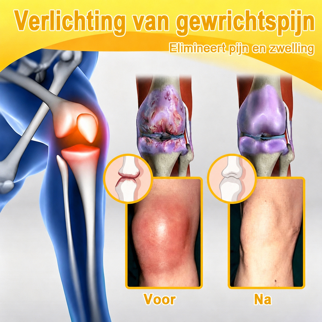 🔥 Laatste kans! Profiteer nu van deze geweldige aanbieding met 80% KORTING!  🎁 180 dagen niet-goed-geld-terug-garantie ✈️ Gratis verzending via luchtpost  Natravor®