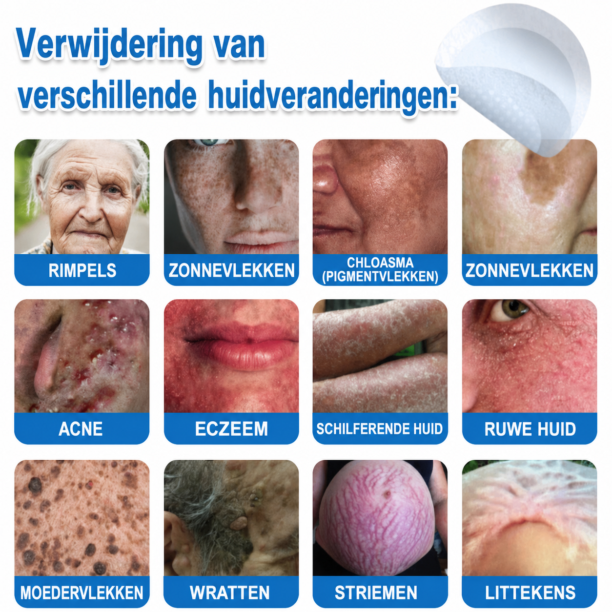 ✨TopSpire® 2-in-1 micronaald- en hydrocolloïdpleisters | Gerichte verzorging voor verheven moedervlekken, acne, platte wratten en steelwratjes | Helpt fijne lijntjes, littekens en huidoneffenheden minder zichtbaar te maken |