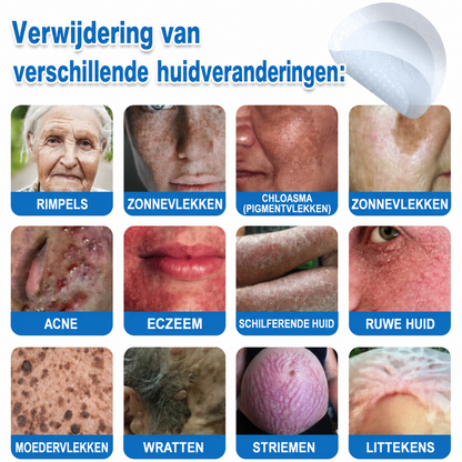✨TopSpire® 2-in-1 micronaald- en hydrocolloïdpleisters | Gerichte verzorging voor verheven moedervlekken, acne, platte wratten en steelwratjes | Helpt fijne lijntjes, littekens en huidoneffenheden minder zichtbaar te maken |