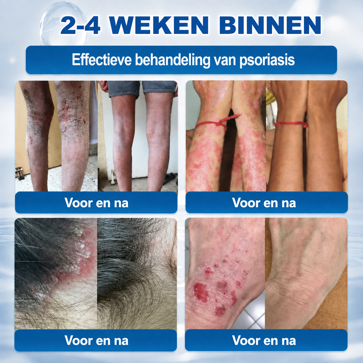 ❤️Natravor® Geavanceerde Corrigerende Crème voor Huidflapjes, Moedervlekken & Vlekken – 7 Dagen Zonder Pijn & Zonder Littekens – Geavanceerde Verzorging voor Huidoneffenheden